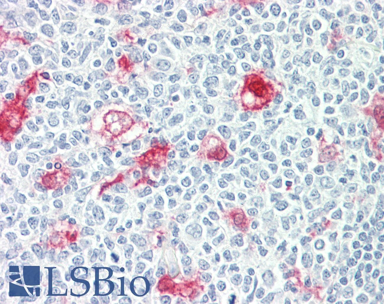 IHC-plus™ SULT1C2 / Sulfotransferase 1C2 Antibody (clone 4H4)