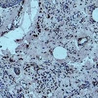 HIST1H3H Antibody