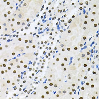 Polyclonal Rabbit anti-Human MCL1 / MCL 1 Antibody (IHC, IF, WB)