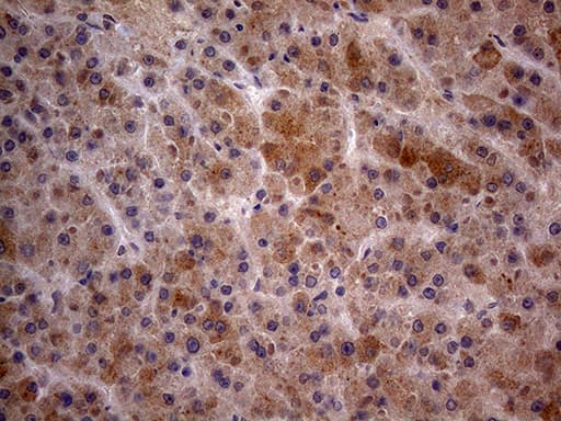 GC / Vitamin D-Binding Protein Antibody (clone OTI2A1)