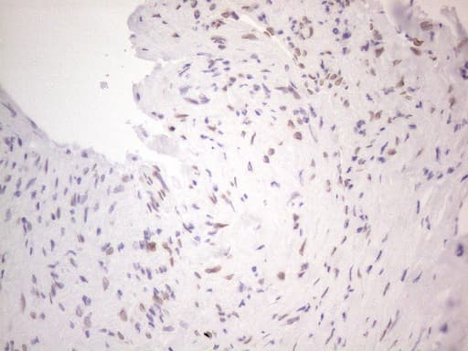 TLK2 Antibody (aa1-296, clone OTI2D10)