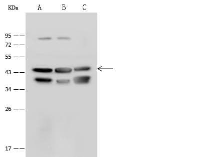 ATP6V0D1 Antibody