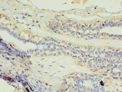 GK2 / Glycerol Kinase 2 Antibody (aa2-553)