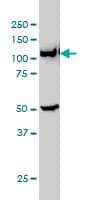 IHC-plus™ Monoclonal Mouse anti-Human GART / GARS Antibody (clone 4D6-1D5, IHC, IF, WB)