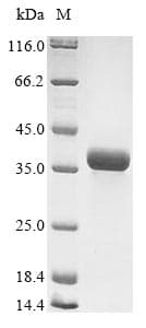 Outer capsid glycoprotein VP7 (Rotavirus A) (Recombinant 10His, N-terminus + Myc, C-terminus)