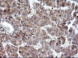 SHBG Antibody (clone OTI1A6, Carrier-free)
