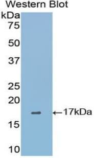 GP1BB / CD42c Antibody (aa52-164, HRP)