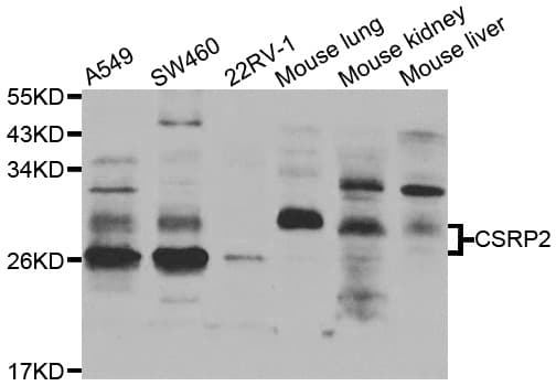 CSRP2 Antibody