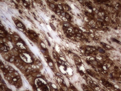 CEACAM5 / CD66e Antibody (aa35-680, clone OTI1D4)