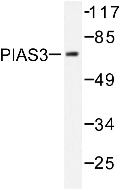 PIAS3 Antibody (Phe25)