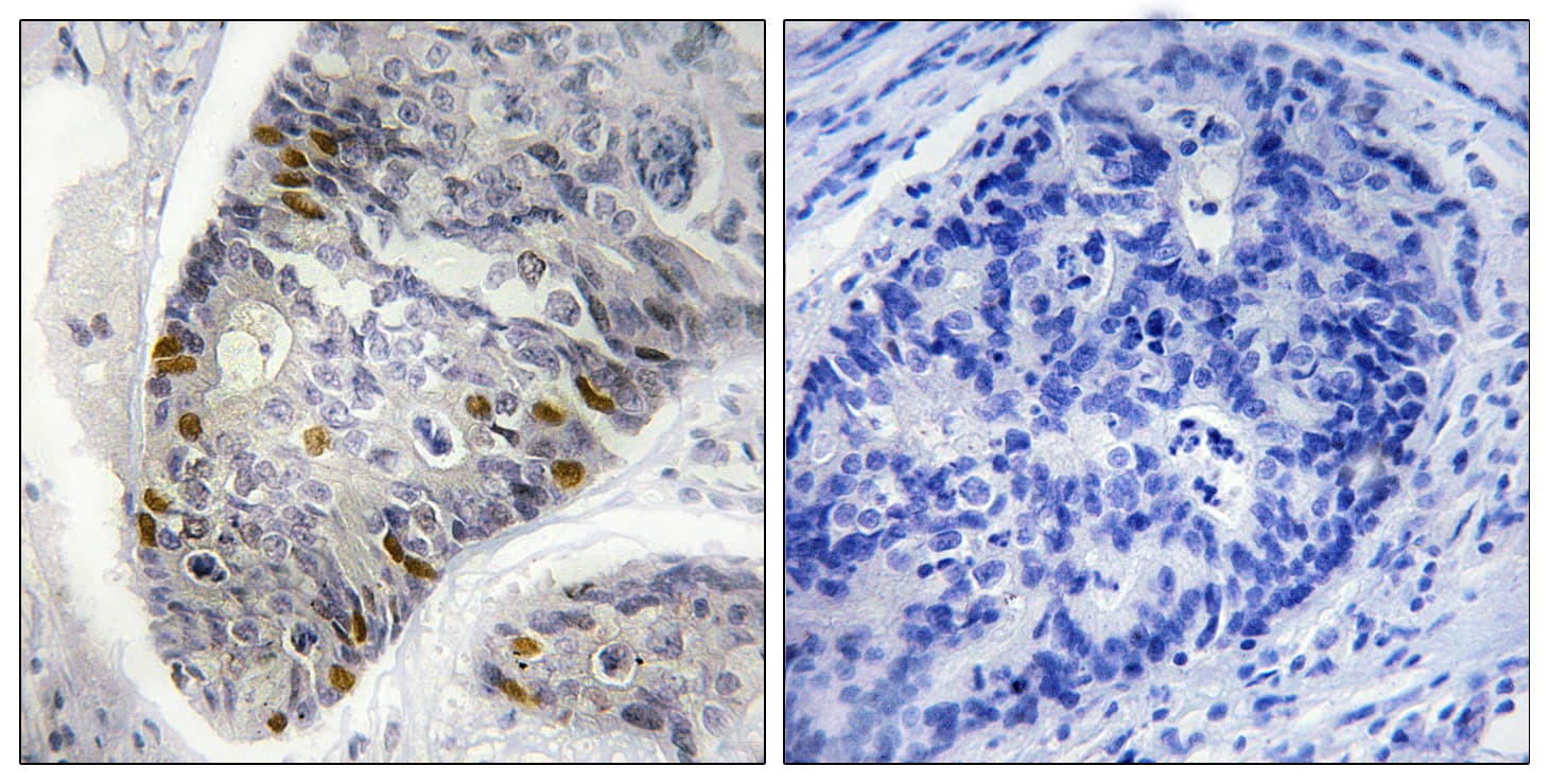 Histone H1 Antibody (phospho-Thr17)