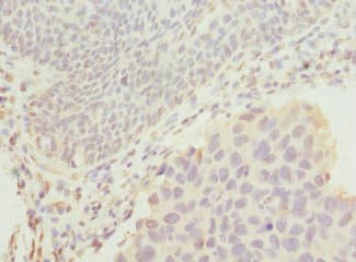 DRAM2 Antibody