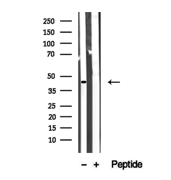 Polyclonal Rabbit anti-Human ACAA1 Antibody (IHC, WB)