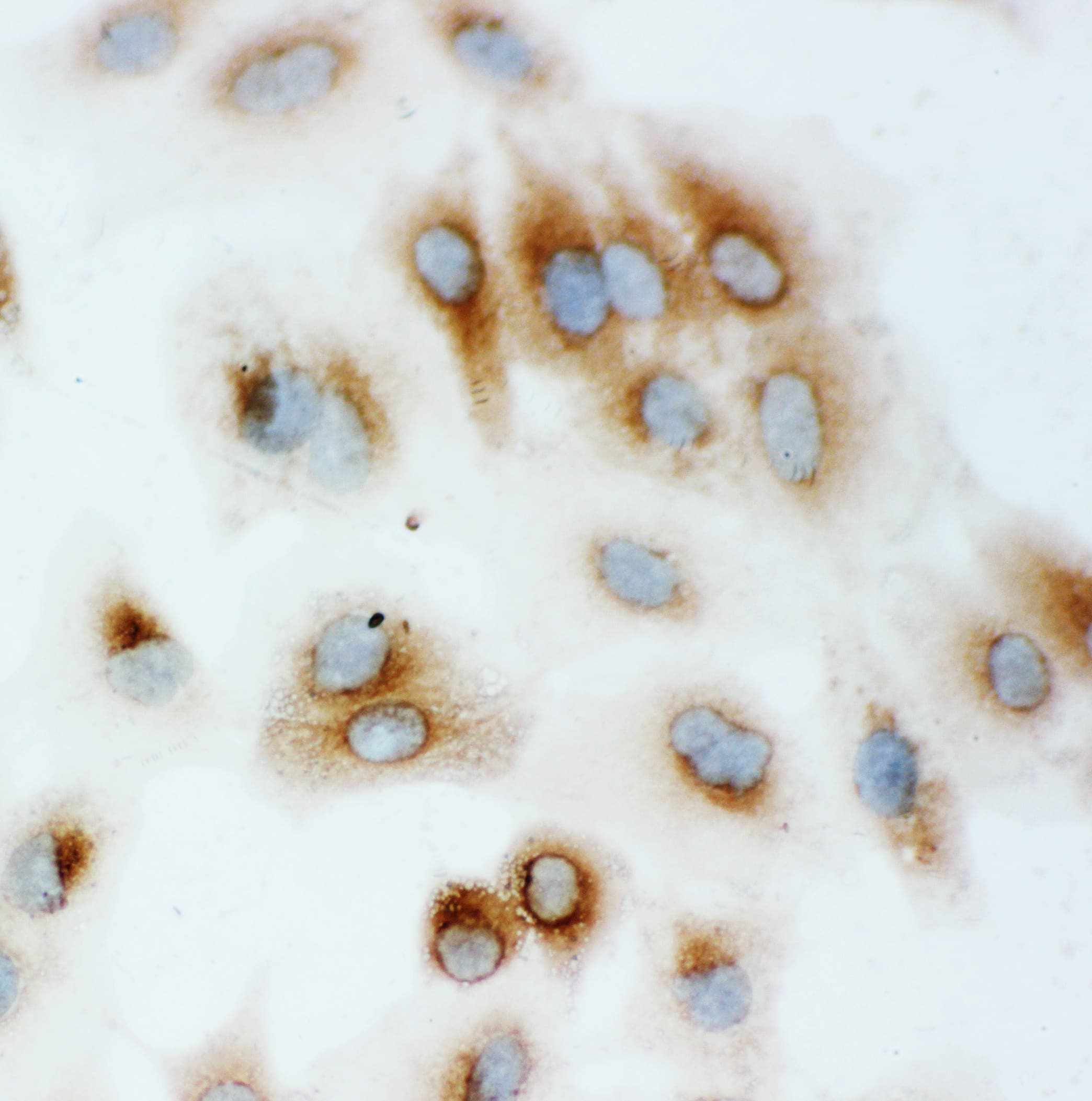 HSP70 / Heat Shock Protein 70 Antibody (aa577-596)