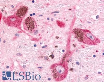 PathPlus™ Polyclonal Rabbit anti-Human MINK1 / MINK Antibody (Internal, IHC)