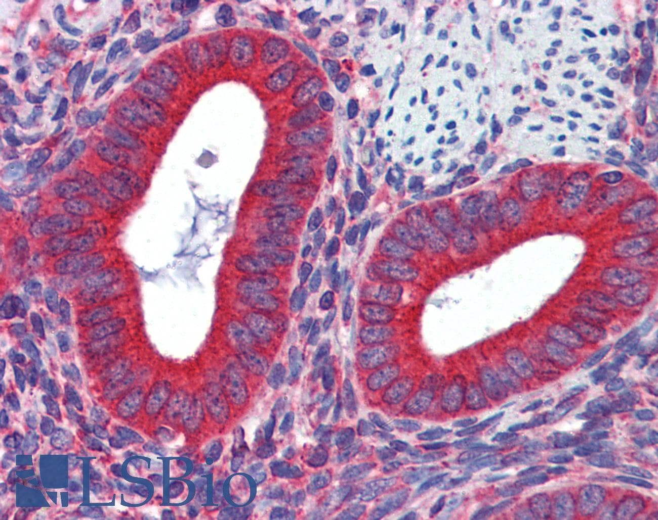 IHC-plus™ Monoclonal Mouse anti-Human WNT5A Antibody (clone 3D10, IHC, WB)
