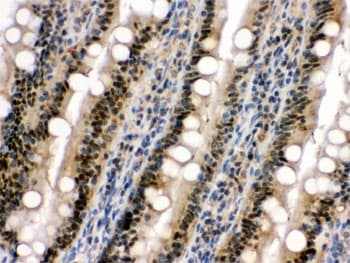MAPK13 / p38delta Antibody