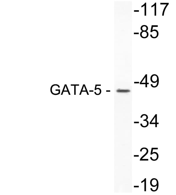 GATA5 Antibody (aa244-293)