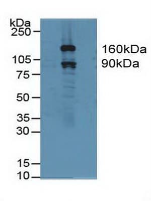 GSN / Gelsolin Antibody (aa577-771)