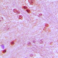 GTF3C3 Antibody (N-Terminus)