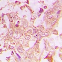 COL10A1 / Collagen X Antibody