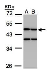 IHC-plus™ CKMT1B Antibody (aa63-287)