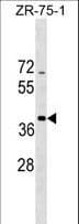 SCO2 Antibody (aa196-224)