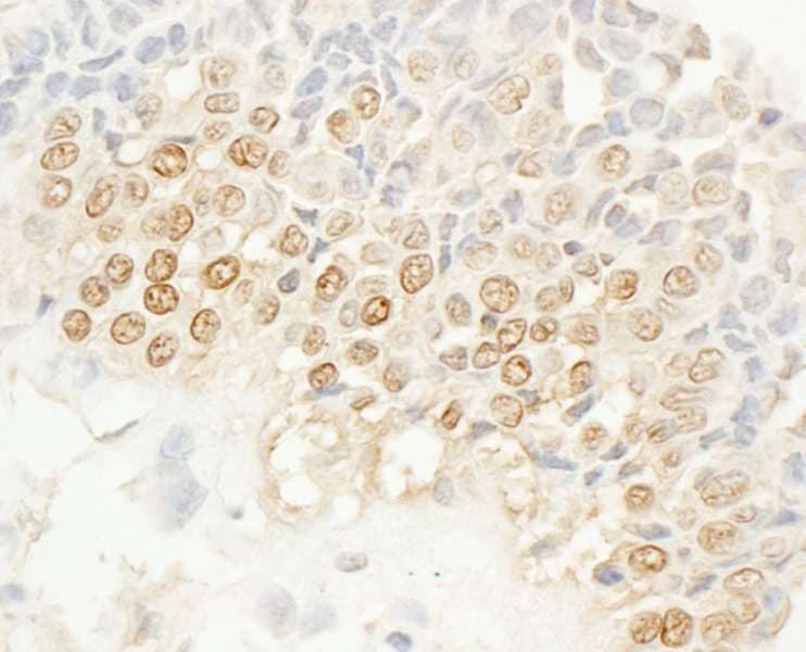 Polyclonal Rabbit anti-Human NEK4 Antibody (aa350-400, IHC)