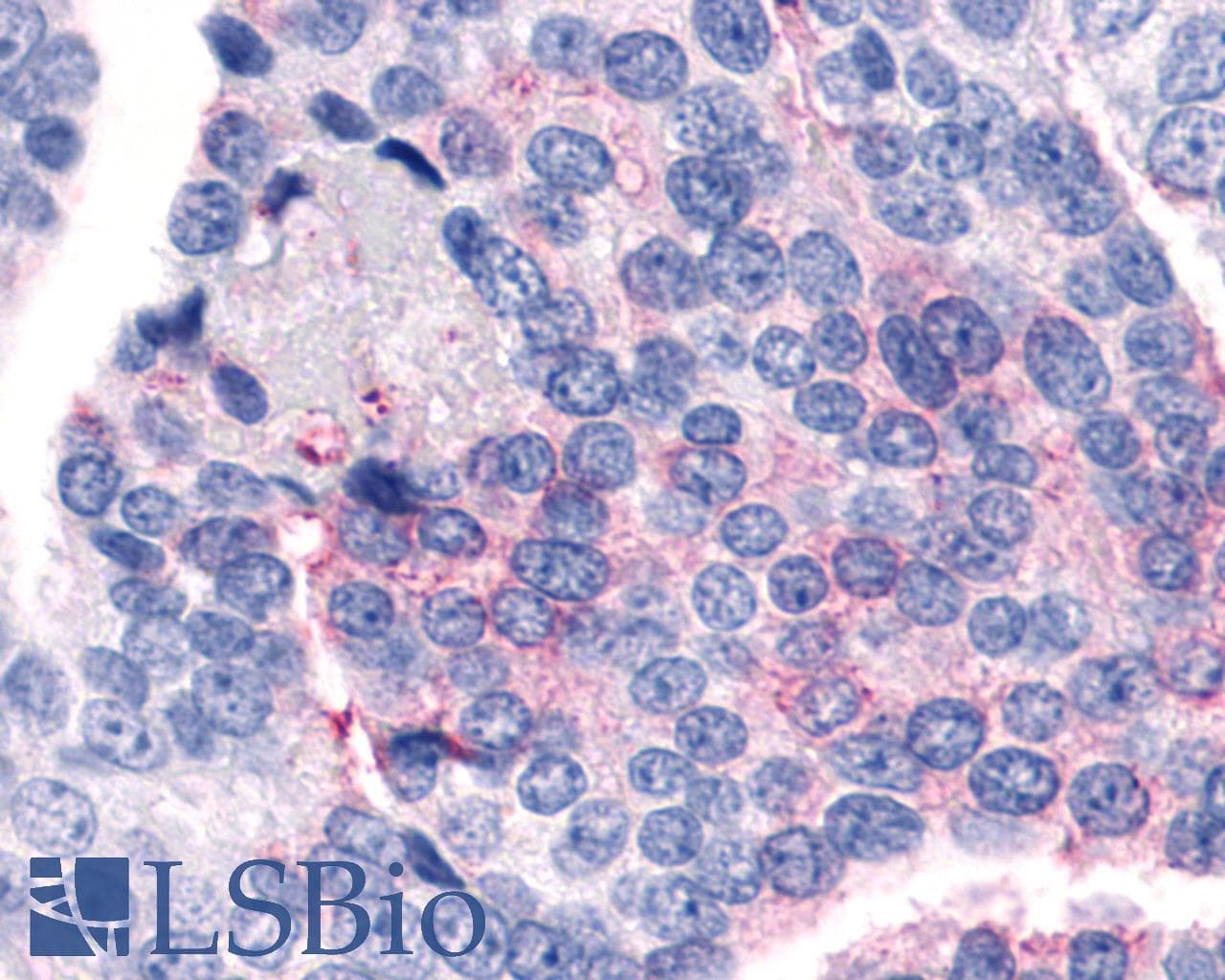 IHC-plus™ F2RL1 / PAR2 Antibody (N-Terminus)