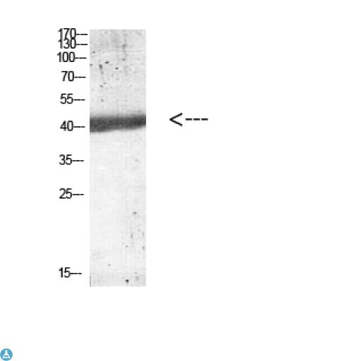 IL12B / IL12 p40 Antibody