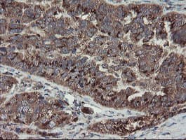 DPH2 Antibody (clone OTI4E7)