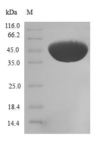 Human CFL2 / Cofilin 2 Protein (Recombinant GST, N-terminus)