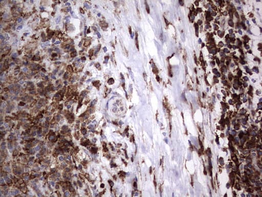 Monoclonal Mouse anti-Human MTDH / Metadherin Antibody (clone OTI2H4, aa70-582, IHC, WB)