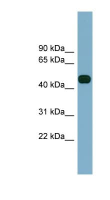 ABHD12 Antibody (aa323-372)