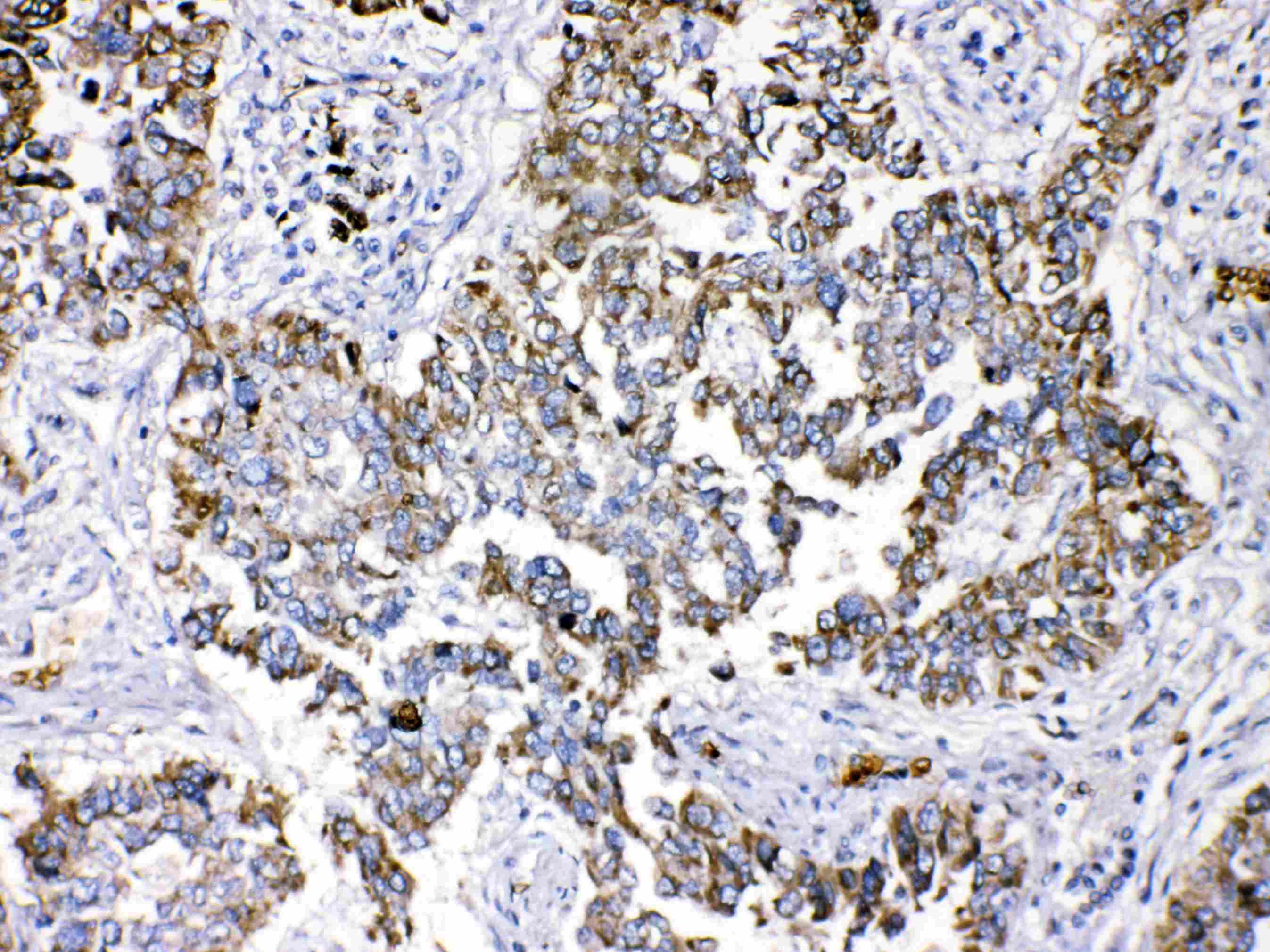 PPL / Periplakin Antibody