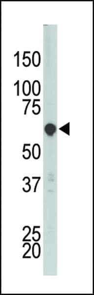 PCTK3 / CDK18 Antibody (aa25-55)