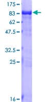 Human TKT / Transketolase Protein (Recombinant GST)