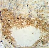 DSC1 / Desmocollin 1 Antibody (aa659-687)