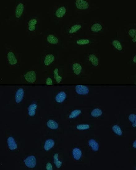BSAC / MKL1 Antibody
