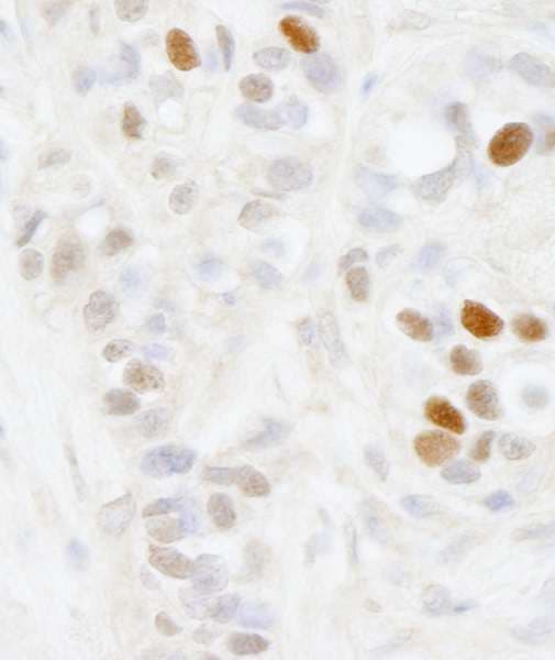 Polyclonal Rabbit anti-Human MAGED2 Antibody (aa50-100, IHC)