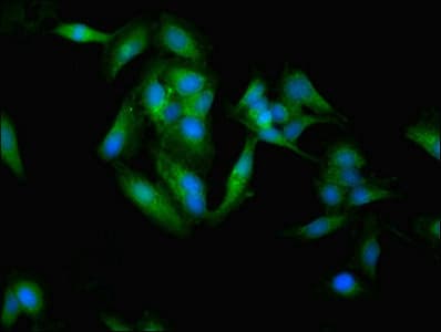 Polyclonal Rabbit anti-Human SOCS3 Antibody