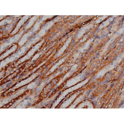 MAPT / Tau Antibody (phospho-Ser422)