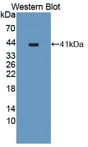 PC5 / PCSK5 Antibody (aa115-454)