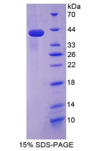 Human HNP-4 / DEFA4 Protein (Recombinant His-GST)