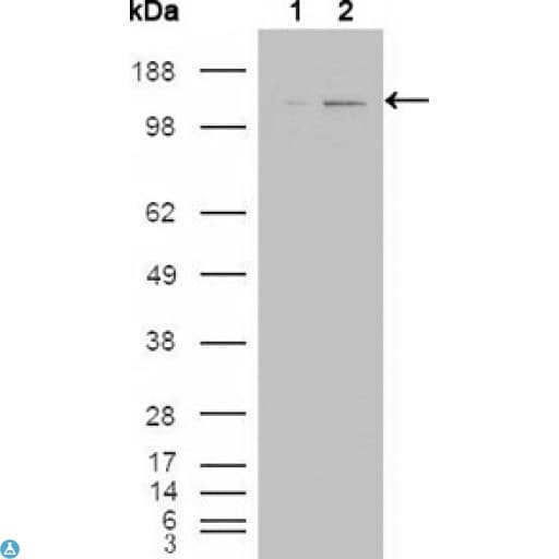 ABL2 Antibody