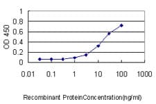 IHC-plus™ Monoclonal Mouse anti-Human EIF2B2 Antibody (clone 5B12-E10, IHC, WB)
