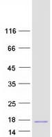 Human NUPR1 Protein (Recombinant Myc-DDK (Flag))