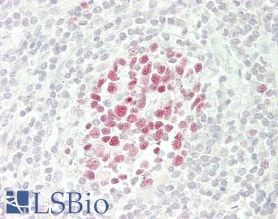 IHC-plus™ Polyclonal Rabbit anti-Human MCM2 Antibody (IHC, WB)