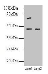 IHC-plus™ EIF4A2 Antibody (aa1-407)