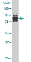 IHC-plus™ IFI16 Antibody (clone 4E6)